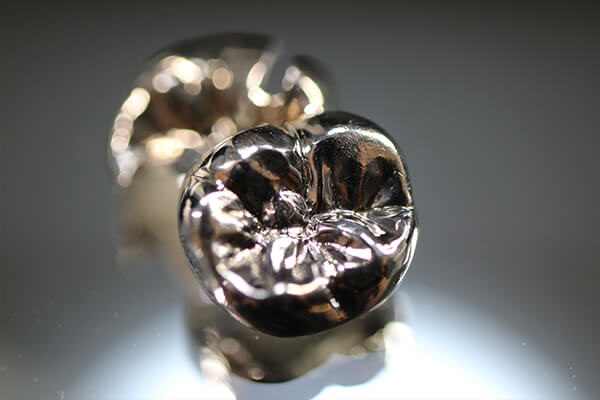 素材による金属アレルギーにご注意を！