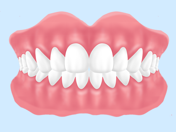 保険適用・入れ歯