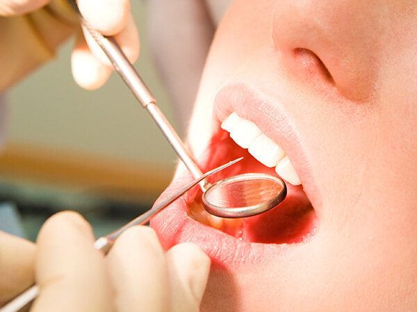 ④ お口のチェックと、むし歯の検査