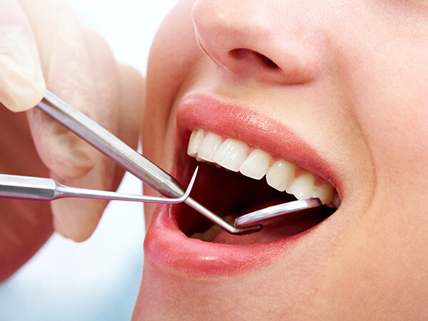 日本と歯科先進国の予防歯科に対する意識の違い